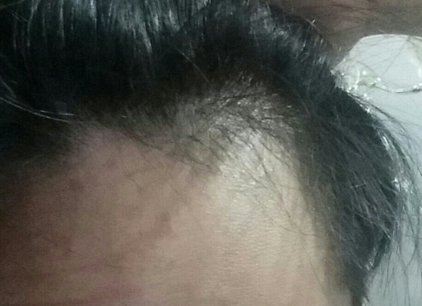 왼쪽 개털리는 부분이구요 밀도가 거의 없다시피 합니다.