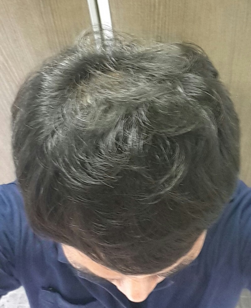 20160706_142642-1.jpg