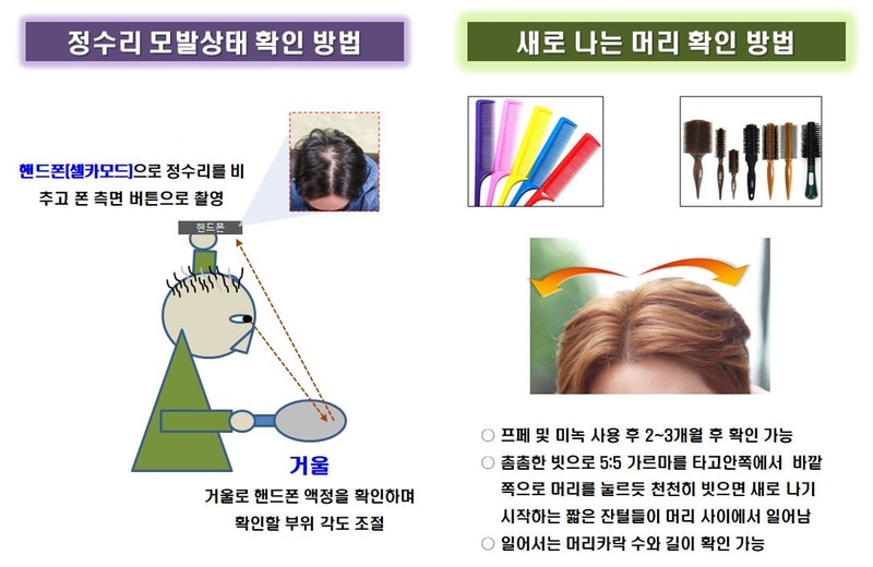 모발확인.JPG