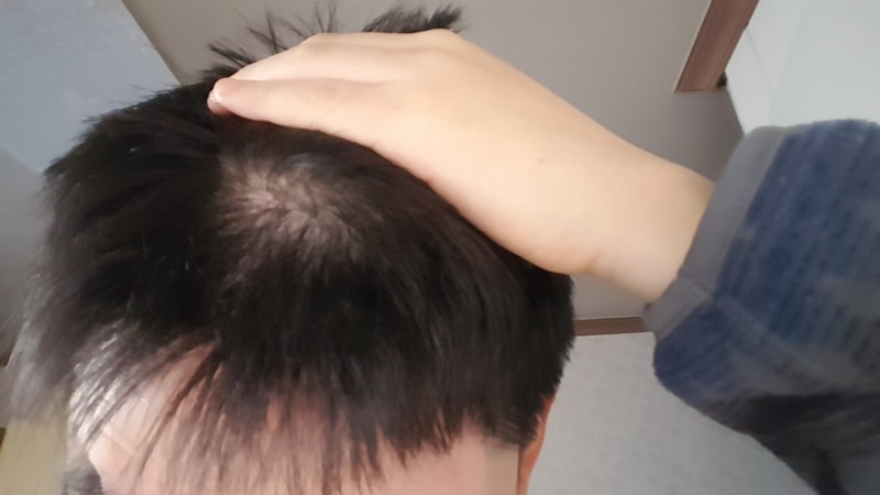 1583449615392763919533507858102.jpg
