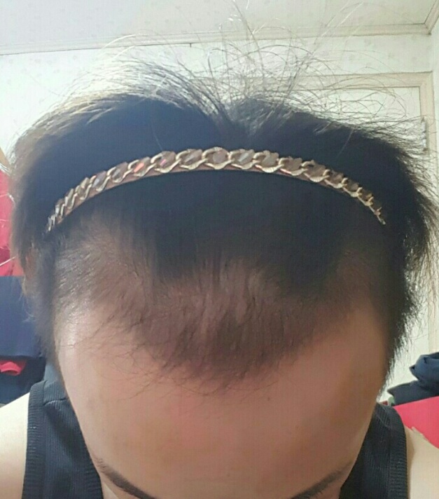 20170508_201007.jpg