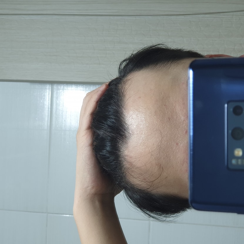 정면