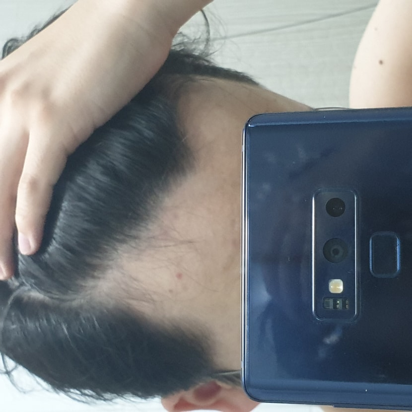 좌측(요즘 점점더 빠지는듯한 느낌)