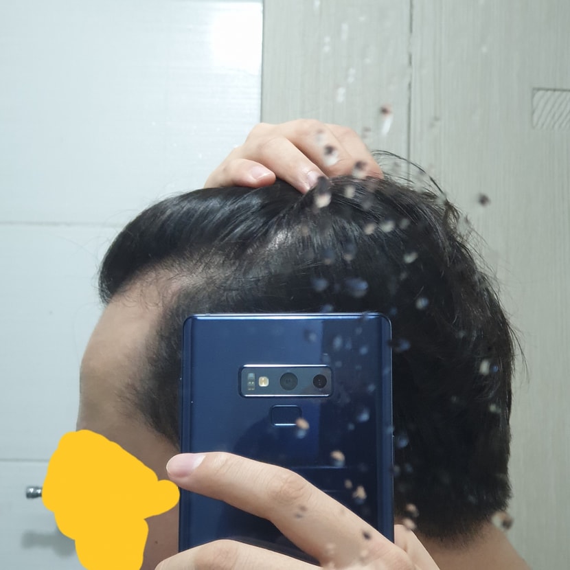 우측(제일 숱이없다고 생각)