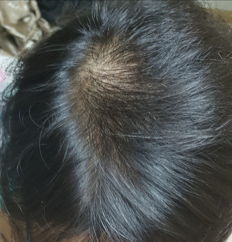 20180130_202823.jpg