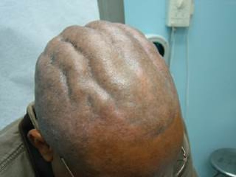 dc0207-case1_52914.jpg