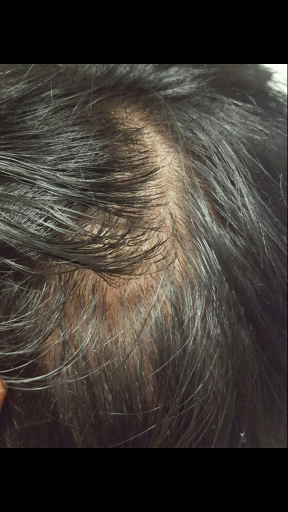 정수리1.jpg