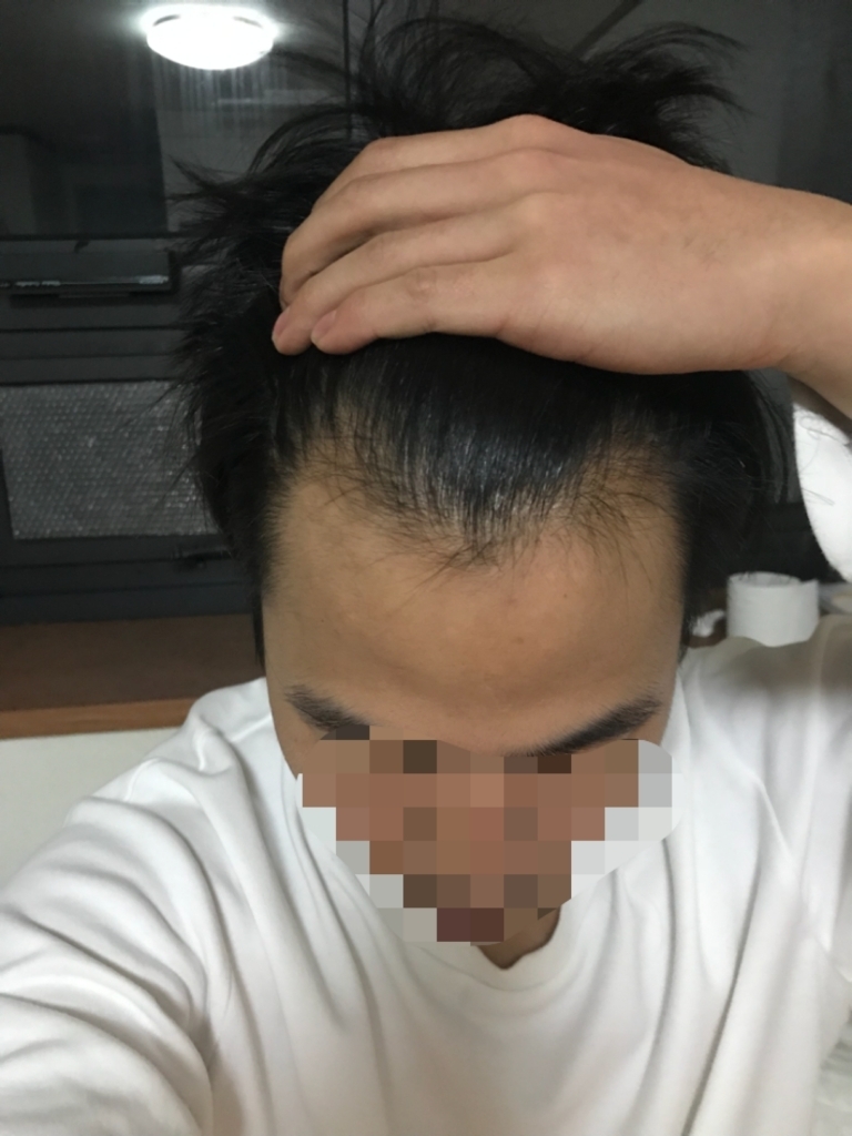 FC0EDC29-721C-481D-B1BD-93992D5B955B.png