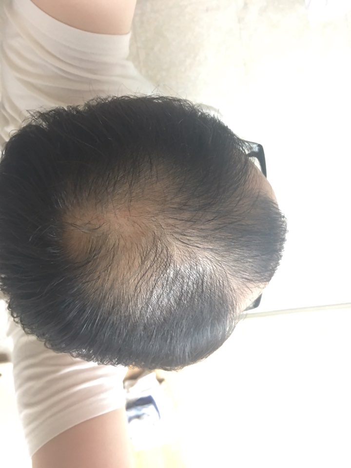 KakaoTalk_20170918_200305529.jpg