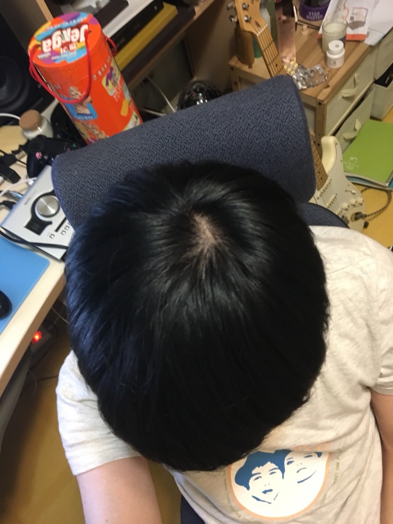 KakaoTalk_20171109_233839875.jpg