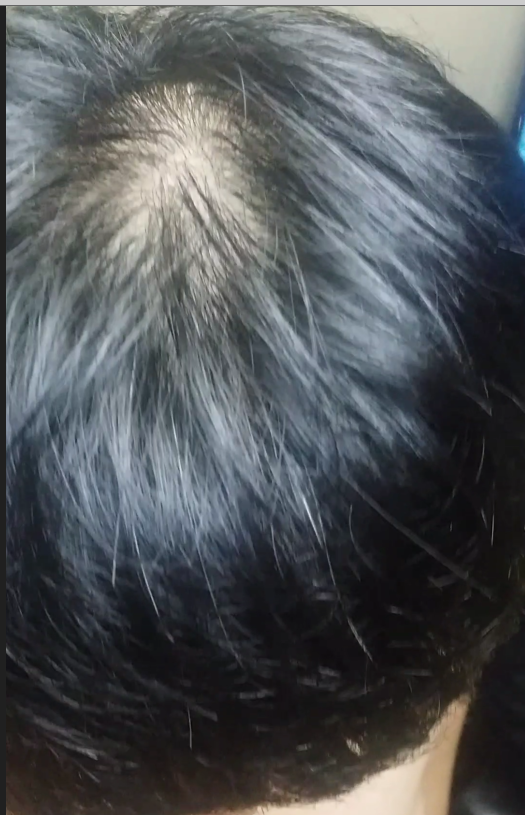 5.PNG