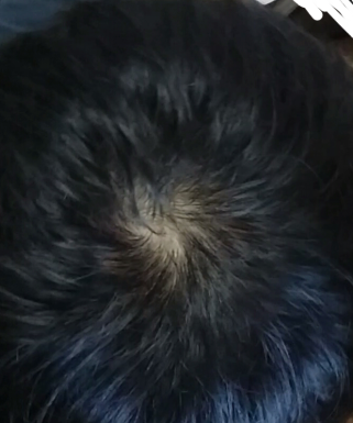 2.PNG