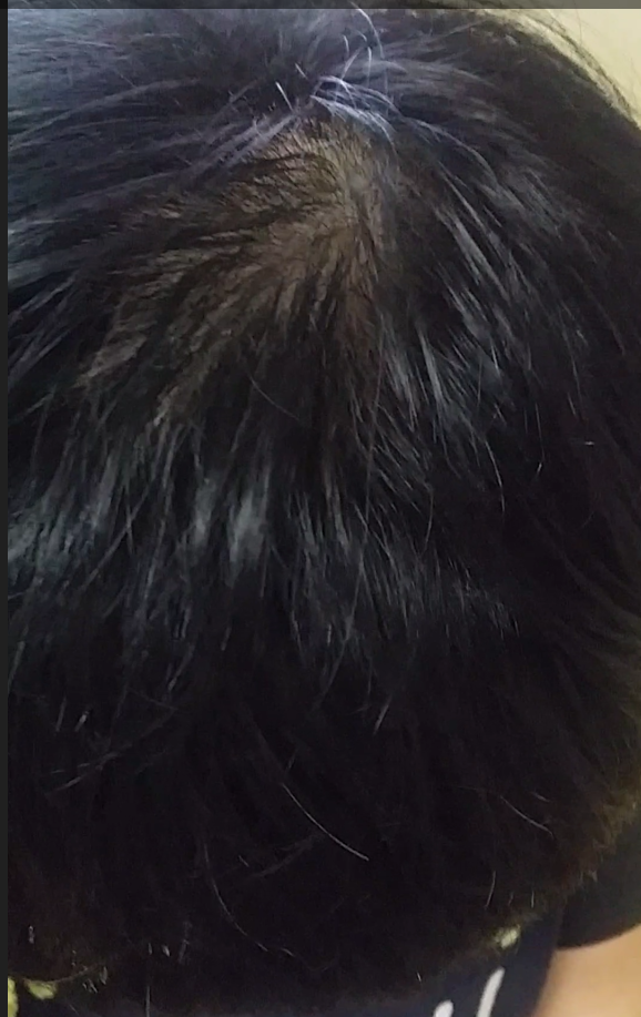 2.PNG