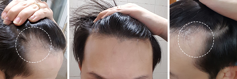 왼쪽오른쪽정면.jpg