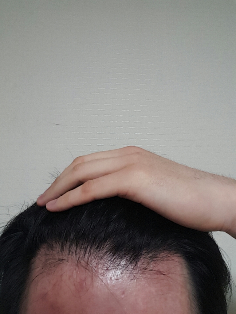 B612_20170109_233319.jpg