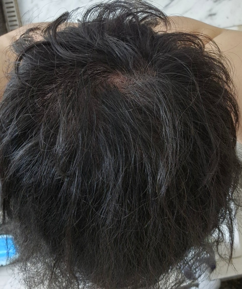 현재