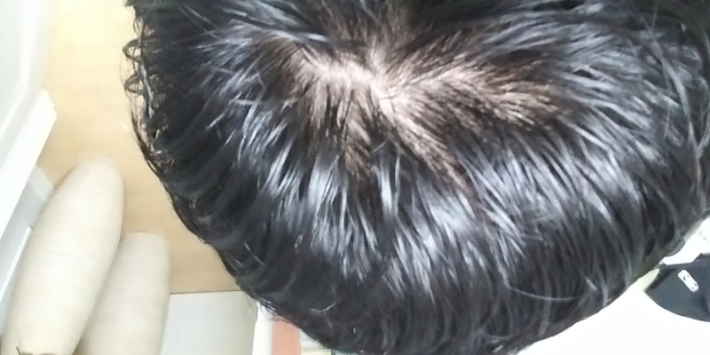 20170818_140345.jpg