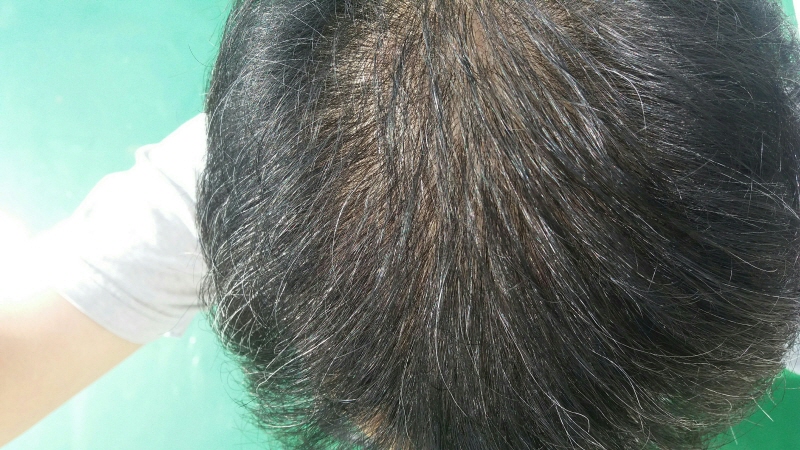 크기변환_20160706_155444.jpg