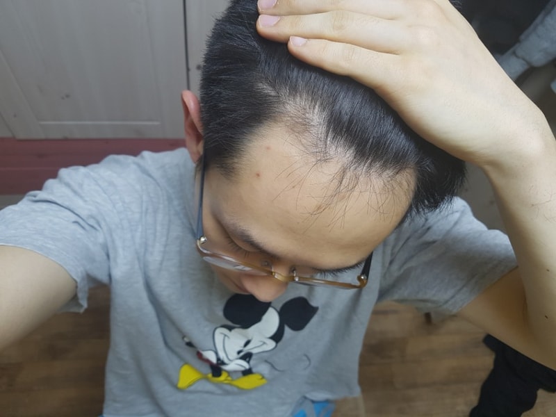 1년우측 1.jpg
