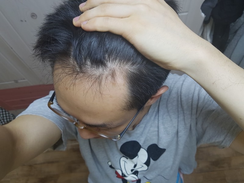 1년좌측2.jpg