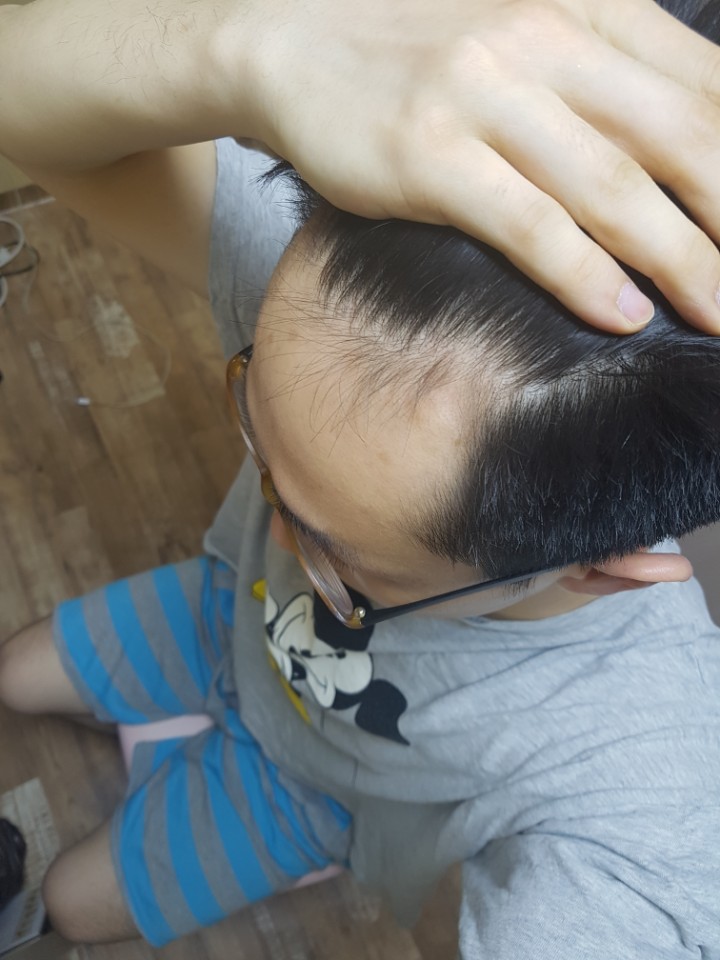 1년 좌측.jpg