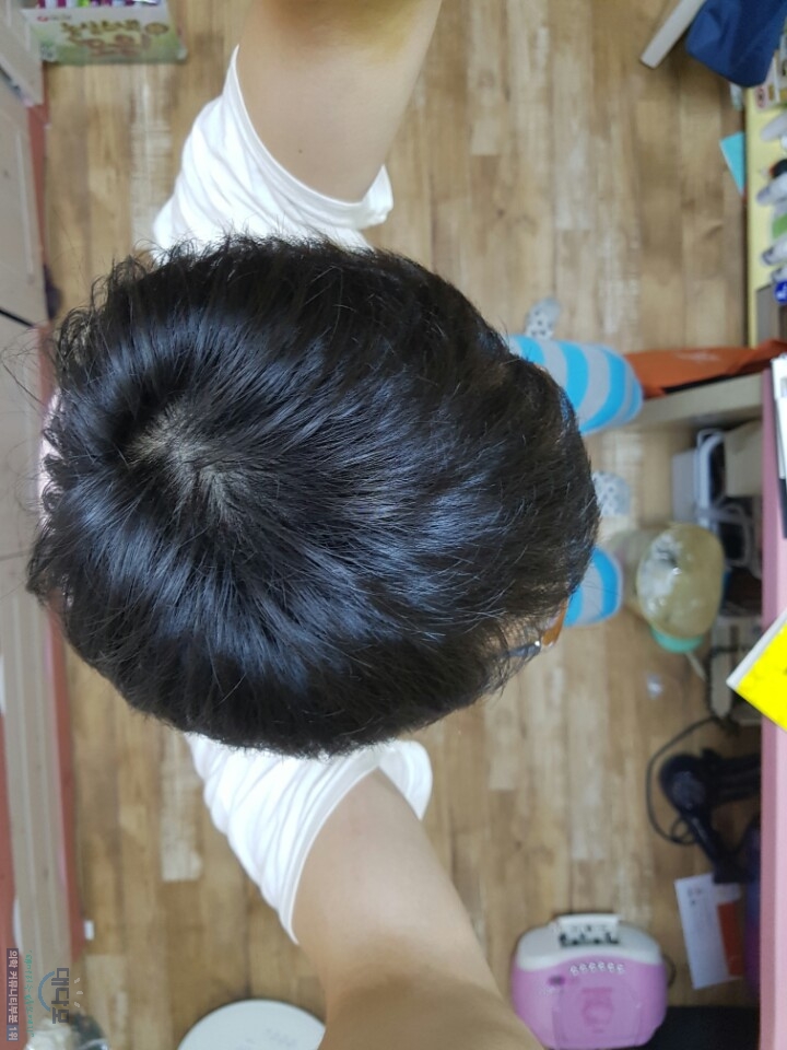 2016년 8월7일 4개월 정수리.jpg