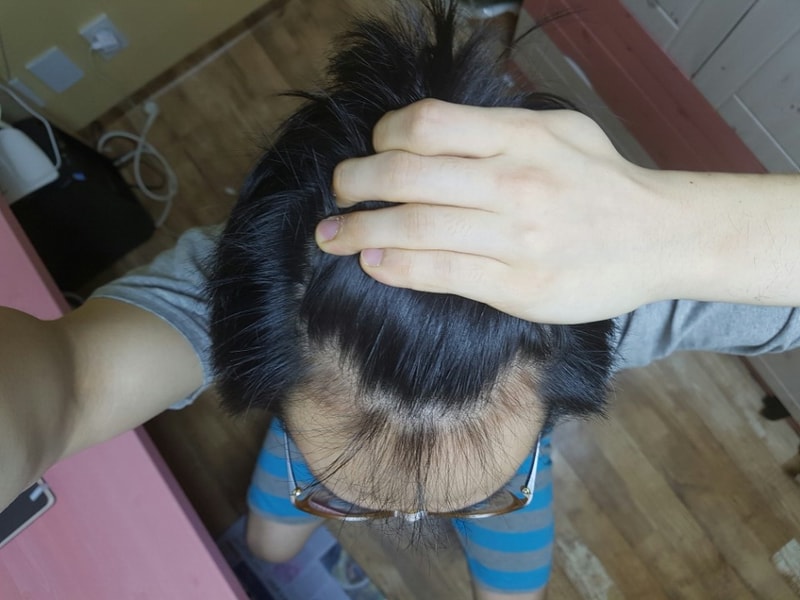 10개월 엠자 위에서 1.jpg
