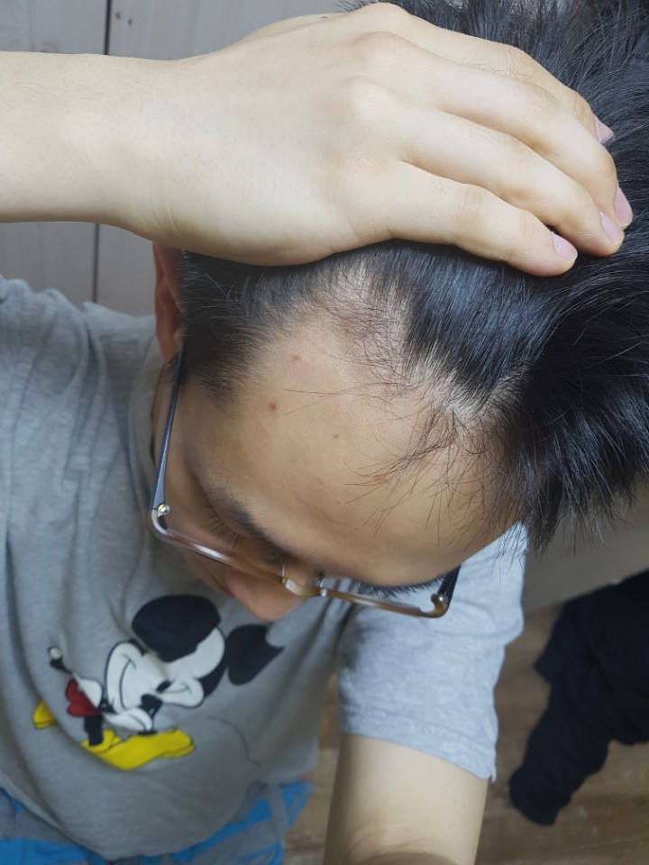 1년 우측2.jpg