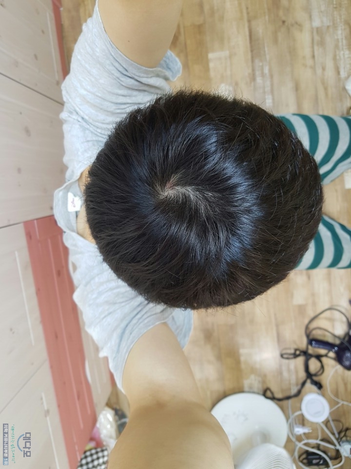 3개월 정수리2.jpg