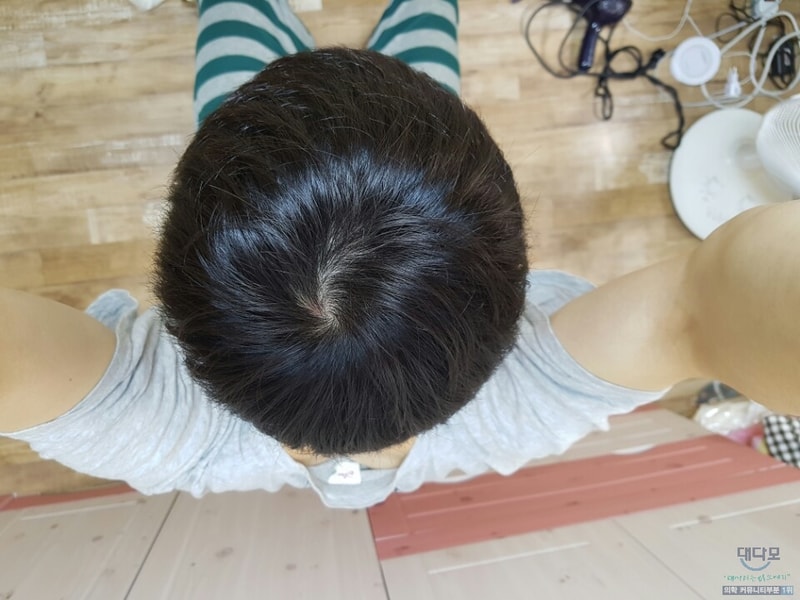 3개월 정수리2.jpg