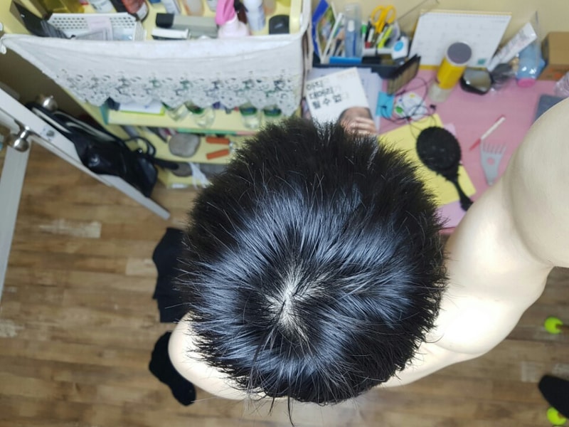 정수리9개월 2.jpg