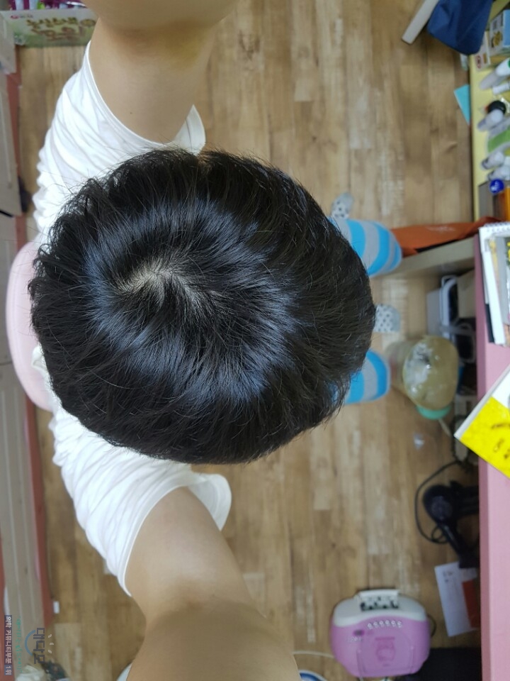 2016년 8월7일 4개월 정수리2.jpg