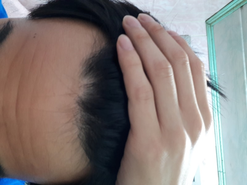 20180910_210336.jpg