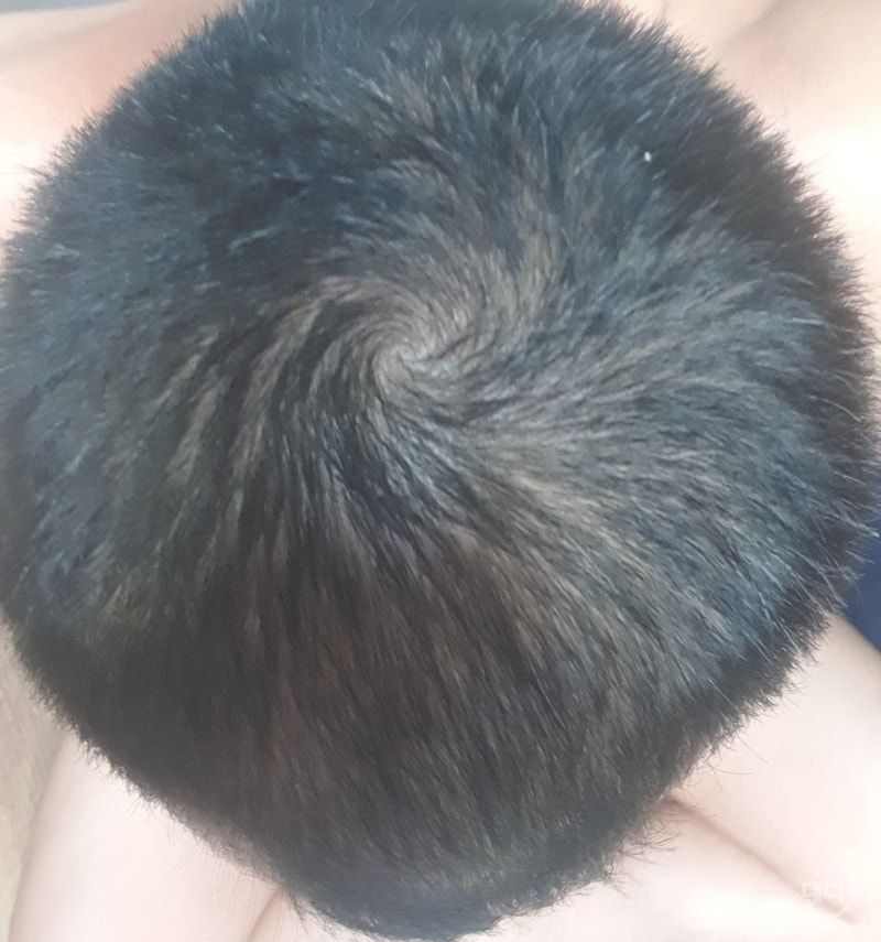 정수리 210730.jpg