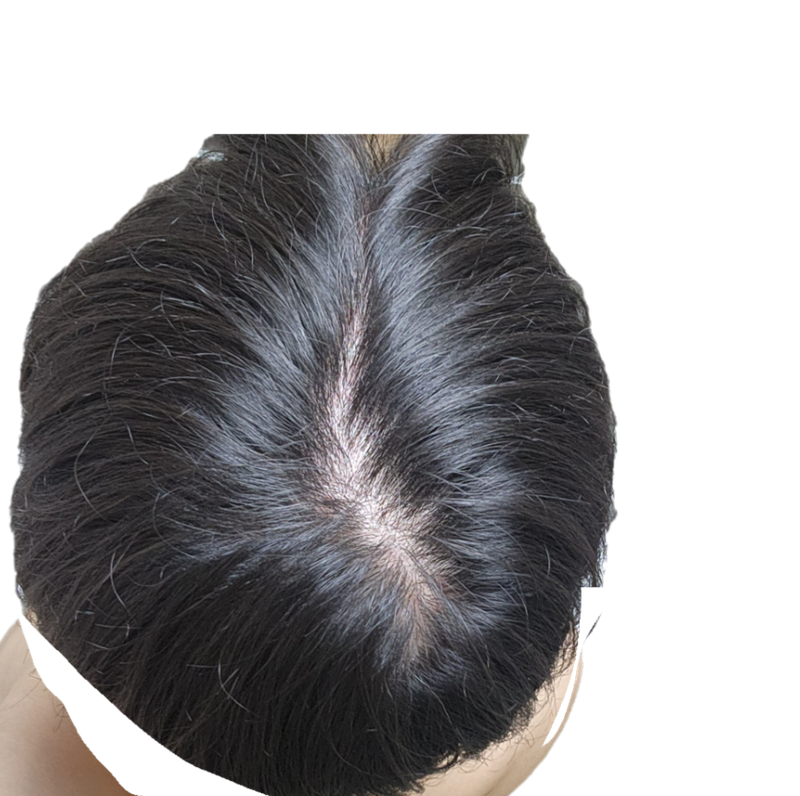 혹시 탈모인지 봐주실 수 있을까요?