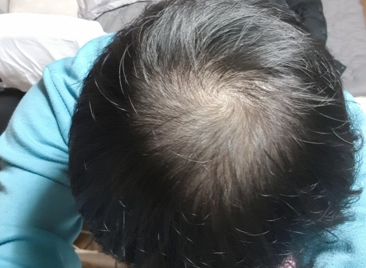 1031 머리감고.jpg