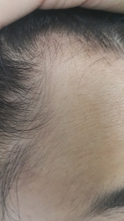 상태호전 대가리 좌측.jpg