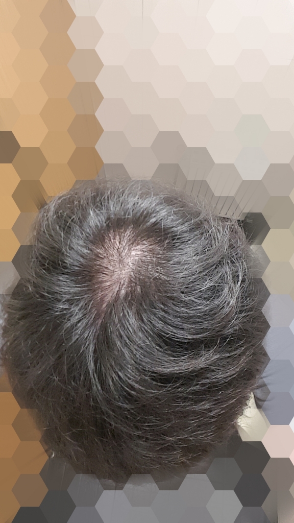 Point Blur_Oct132018_120719.jpg