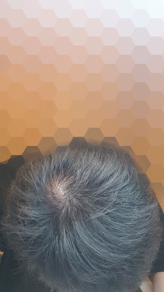 Point Blur_Nov082018_135317.jpg