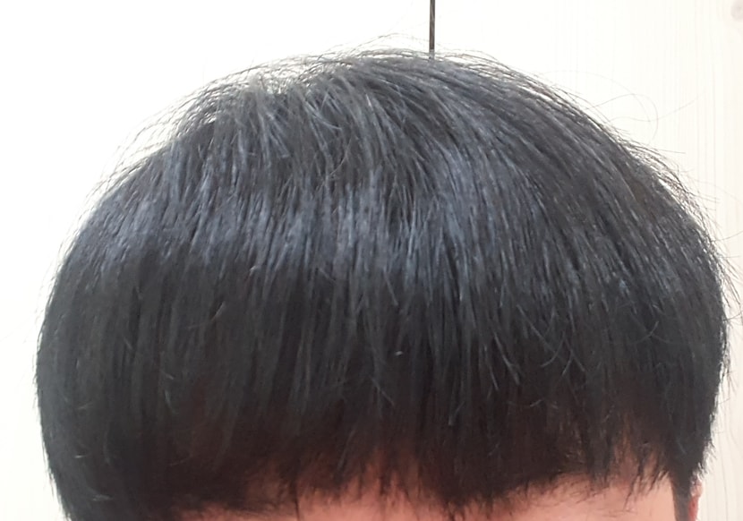앞머리 내림