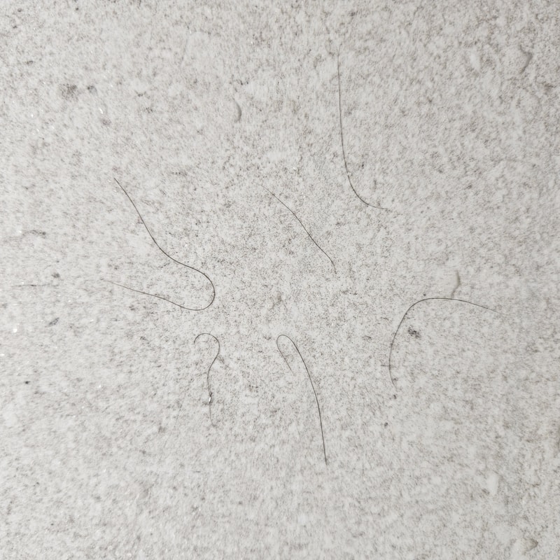 이런 잔머리? 엄청 짧은 모발이 빠지는데 안좋은거죠???