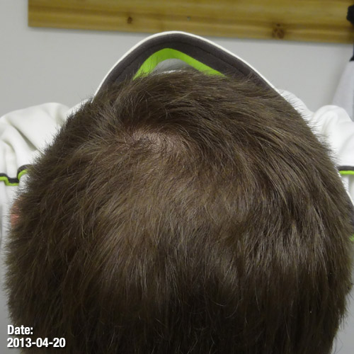 2013-04-20-crown.jpg