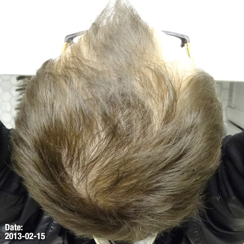 2013-02-15-crown.jpg