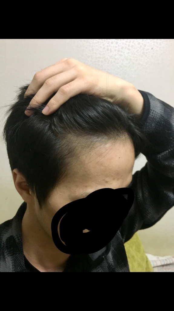 5A7FEB2F-AF98-4AC2-8C3C-D9E9BCC502E6.jpeg