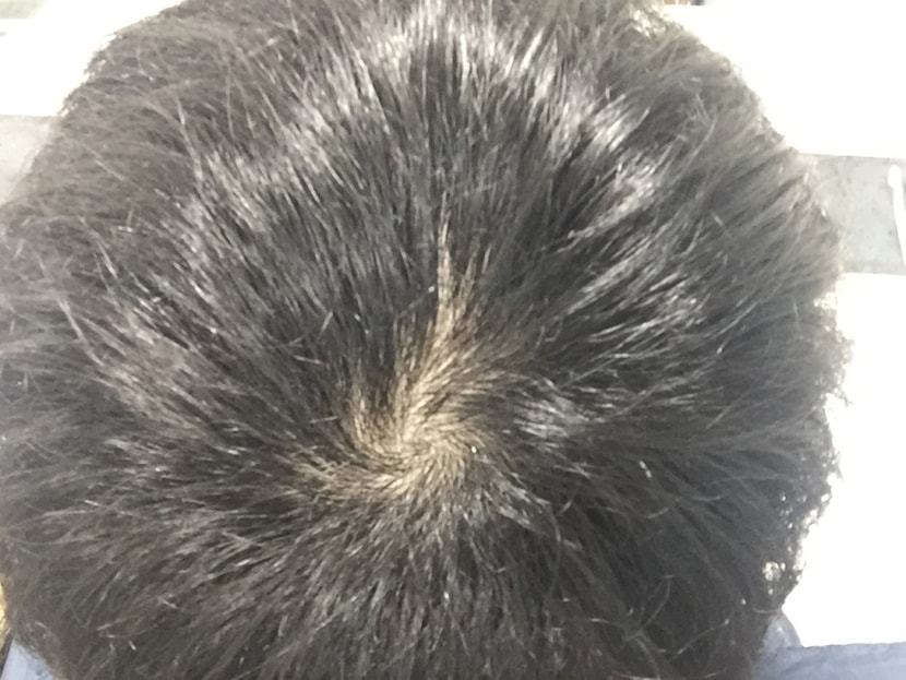 이게 평소 머리감고 일상생활할때 머리. 위에 3장은 방금 세수해서 쫌 헝크러져 있는거