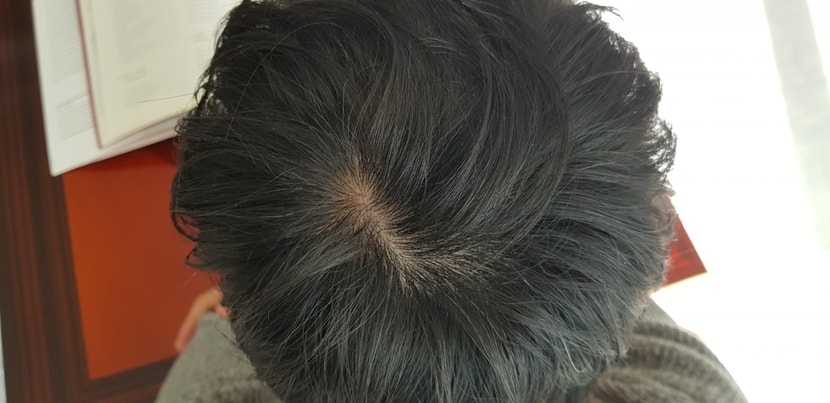12.1. 정수리