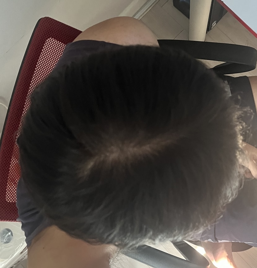 그늘 