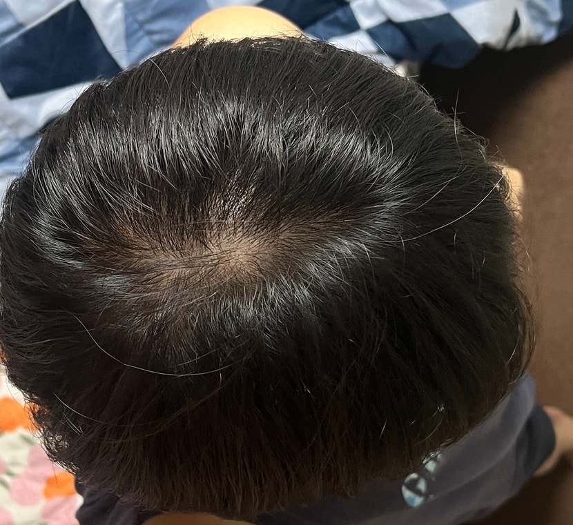 빛이 있을 때 