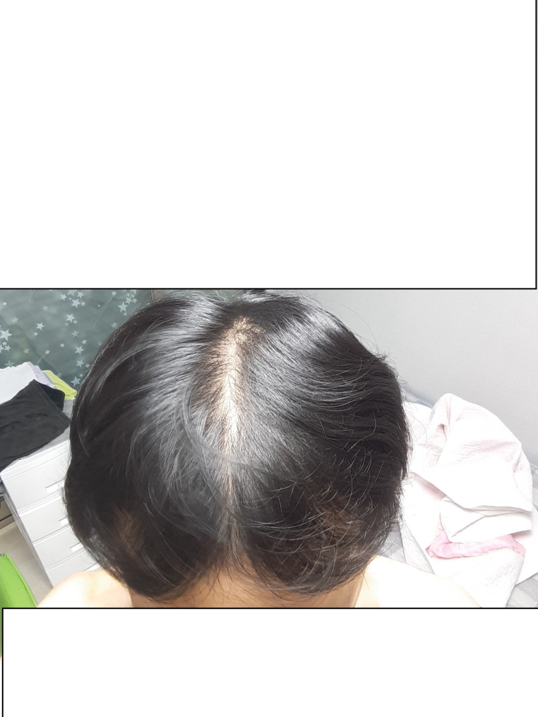 3) 20180714 상.jpg
