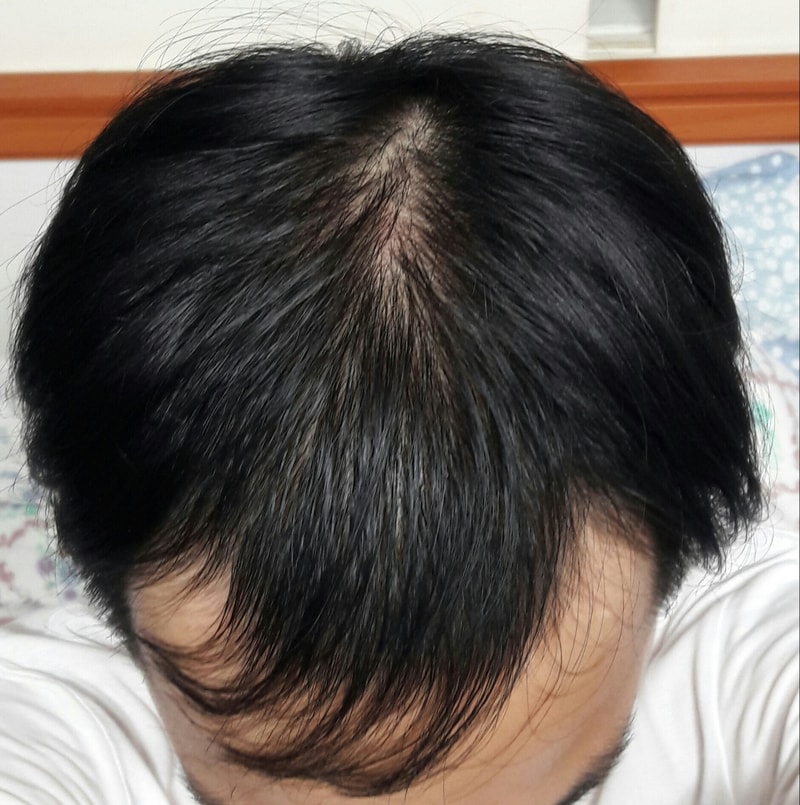 2) 20170703 상.jpg